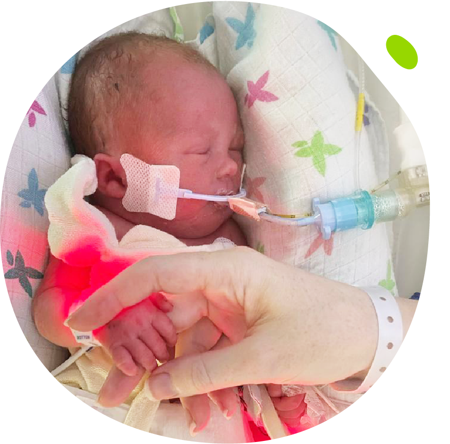 Ella's Mito Mission - Ella in hospital as a baby